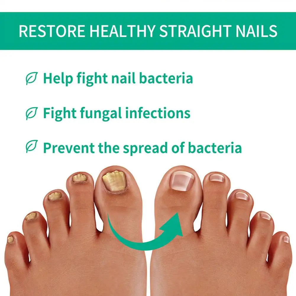 Nail Fungus Remover – Anti Fungal Nail Treatment Solution