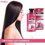 Onion Shampoo – Anti Hair Fall & Hair Growth Shampoo for Strong Smooth Hair