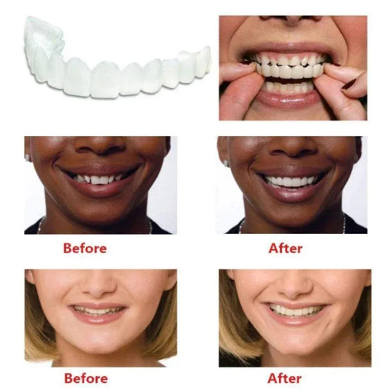Instant Smile Veneers | Temporary Cosmetic Teeth Cover for Perfect Smile