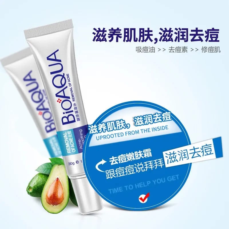 Acne Removal Cream – Anti Pimple & Dark Spot Treatment for Clear Skin