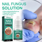 Nail Fungus Remover – Anti Fungal Nail Treatment Solution