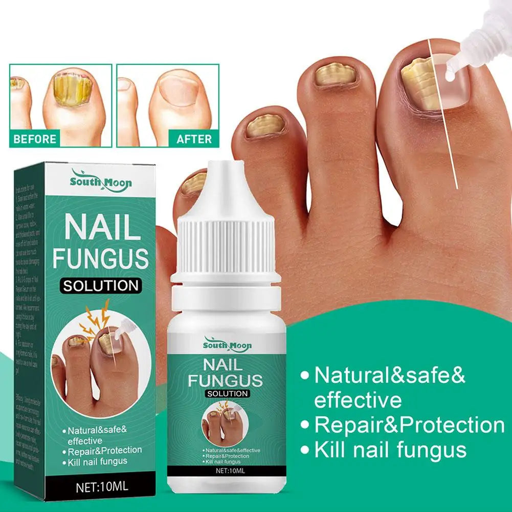 Nail Fungus Remover – Anti Fungal Nail Treatment Solution