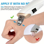 Electric Blackhead Remover Vacuum – Pore Cleaner & Acne Suction Device (5 Heads)